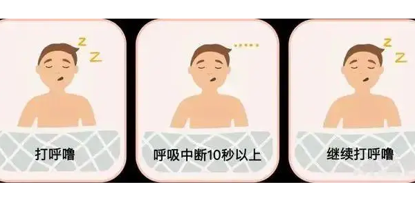你真的了解睡眠呼吸暫停嗎？6600萬中重度患者正在受害！—仟龍醫(yī)療