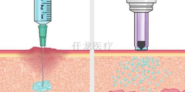 無(wú)針注射器應(yīng)用在哪方面